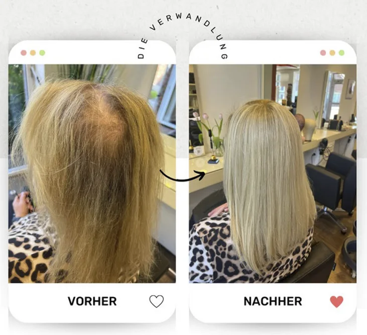 Vorher/Nachher-Vergleich einer Haarverdichtung: dünneres Haar vor der Behandlung, sichtbar vollere und natürliche Frisur nach der individuellen Anpassung bei BRÜHL Haarsysteme